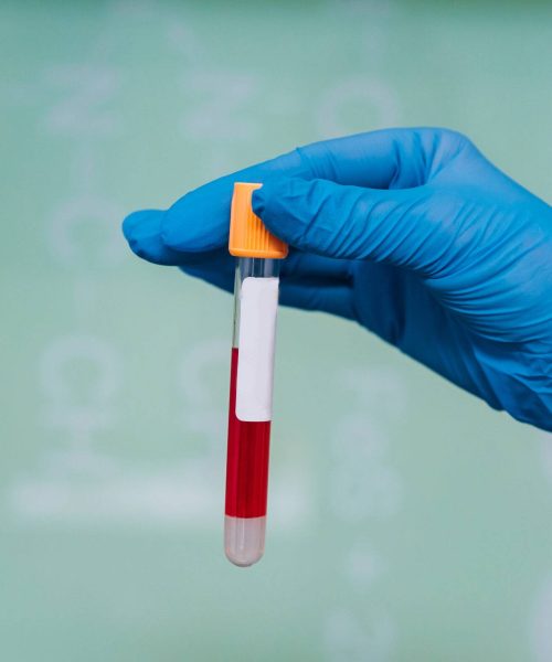 A rubber-gloved hand holds one test tube with the drug, close view