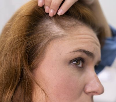 woman-getting-hair-loss-treatment-clinic